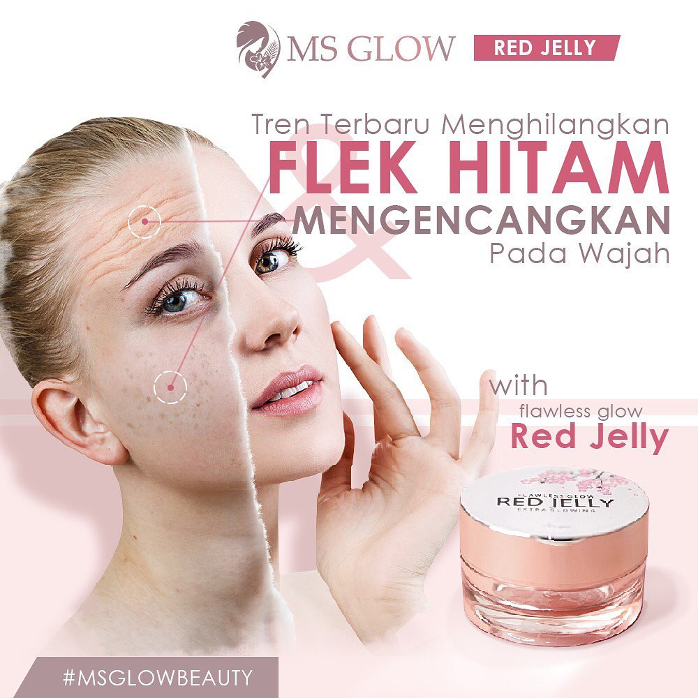Menghilangkan Flek Hitam Dengan Red Jelly MS Glow Menghilangkan Flek Hitam Dengan Red Jelly MS Glow