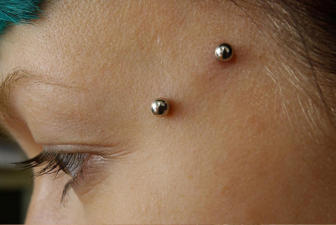 Piercing Rejection & Migration Piercing Rejection & Migration