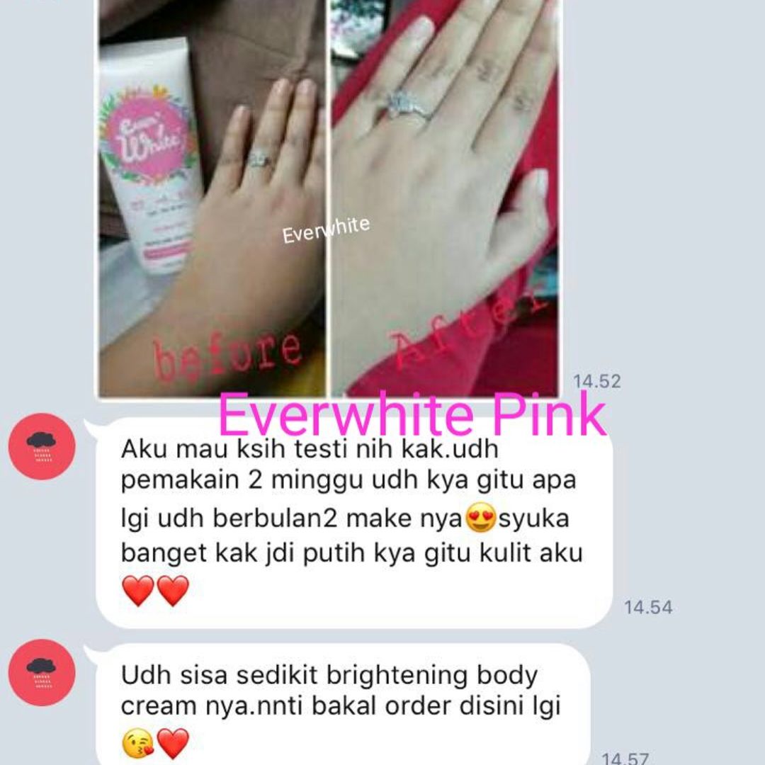 Rajin Pakai Everwhite Brightening Body Cream, ini Manfaatnya !! Rajin Pakai Everwhite Brightening Body Cream, ini Manfaatnya !!