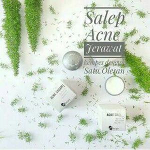 Salep Acne Ms Glow, Manfaat & Cara Pakainya Salep Acne Ms Glow, Manfaat & Cara Pakainya