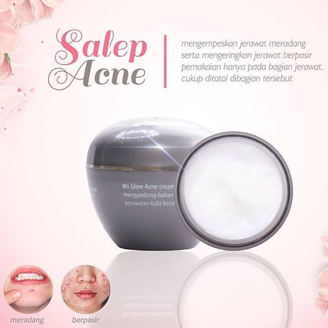 Salep Acne Ms Glow: Manfaat & Cara Pakainya Salep Acne Ms Glow: Manfaat & Cara Pakainya