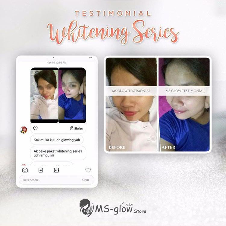 Harga Pemutih Wajah Terlaris: MS Glow Skincare Harga Pemutih Wajah Terlaris: MS Glow Skincare