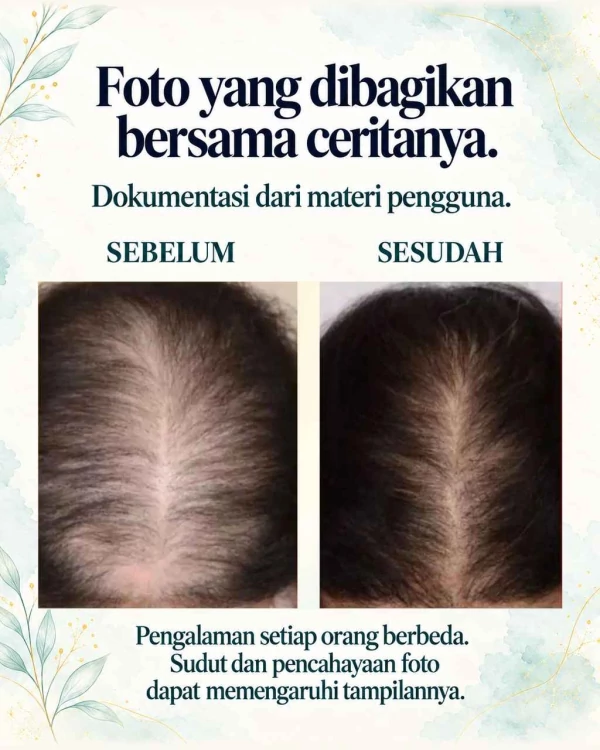 Foto sebelum dari materi pengguna